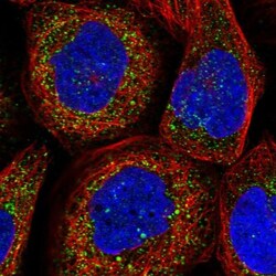 TXNDC11 Antibody, Novus Biologicals 25 &mu;L; Unlabeled:Antibodies, Polyclonal